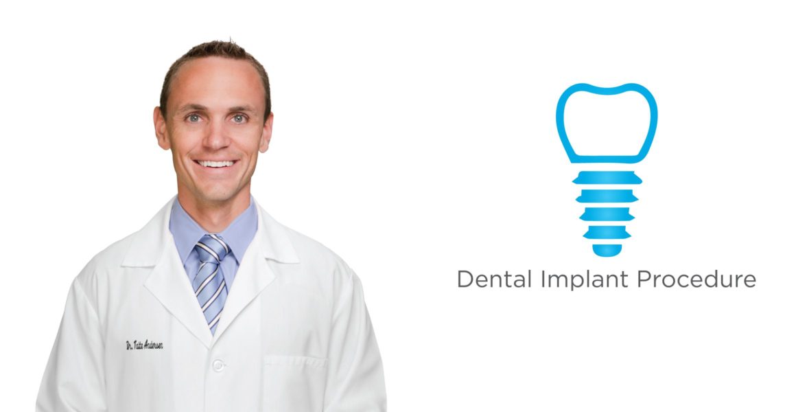 What are dental implants in South Bend, IN?